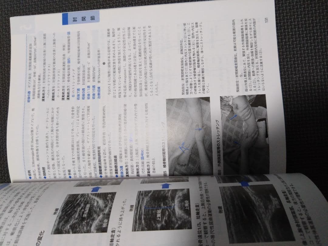 触診技術　整形外科ナビゲーション　上肢2冊セット　理学療法　新人　作業療法　PT