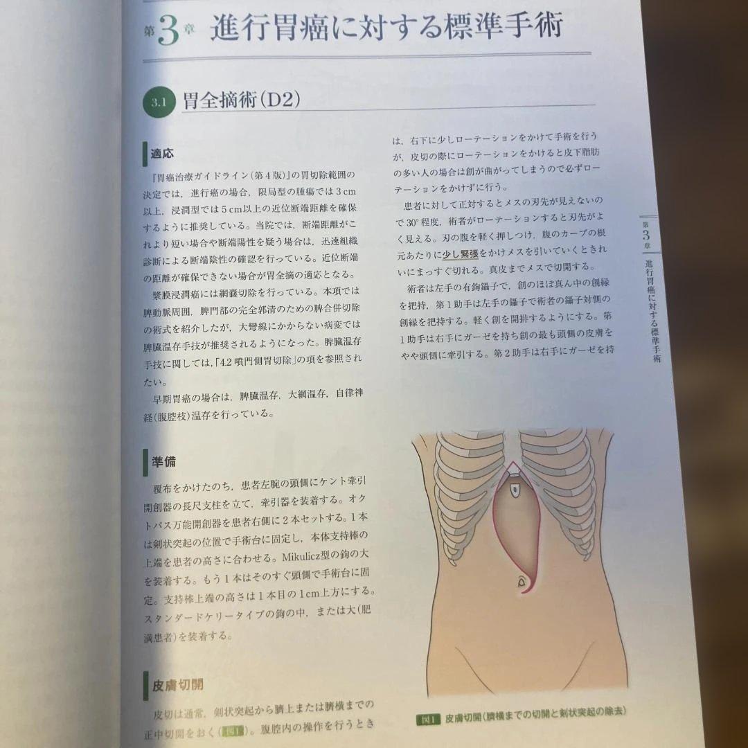 国がんドクター片井の胃外科手術　片井均 著