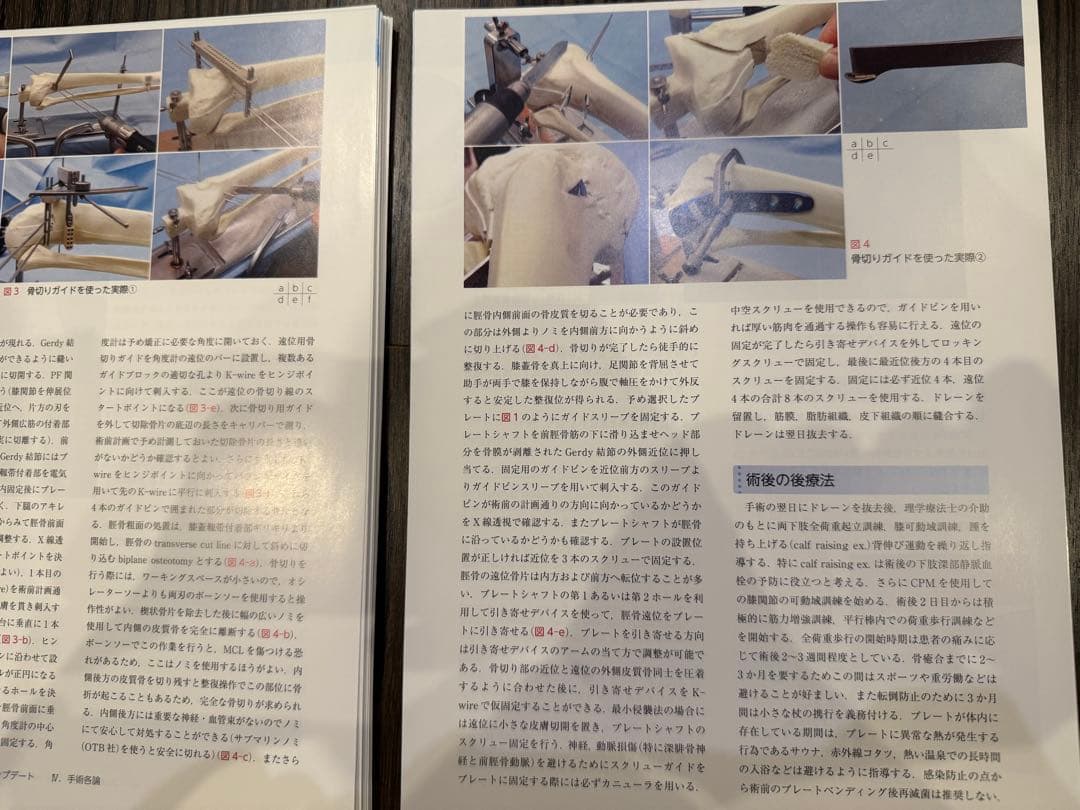ゼロからはじめる!Knee Osteotomyアップデート　裁断済み