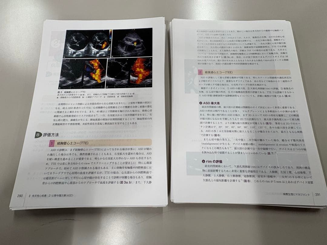 （裁断済）SHDインターベンションコンプリートガイド