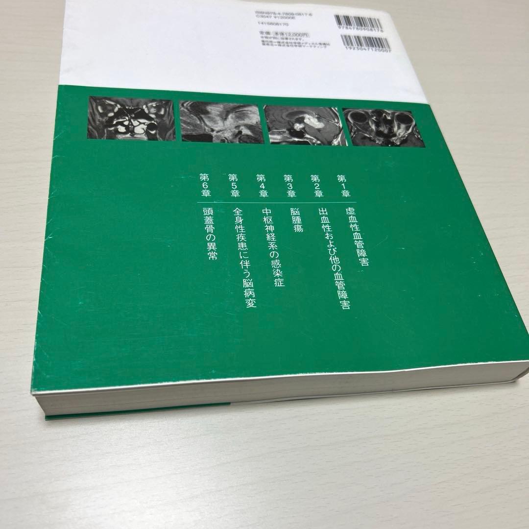 脳MRI 3.血管障害・腫瘍・感染症・他 高橋昭喜 秀潤社