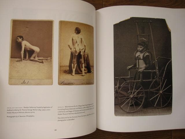 Mutter Museum： Of the College