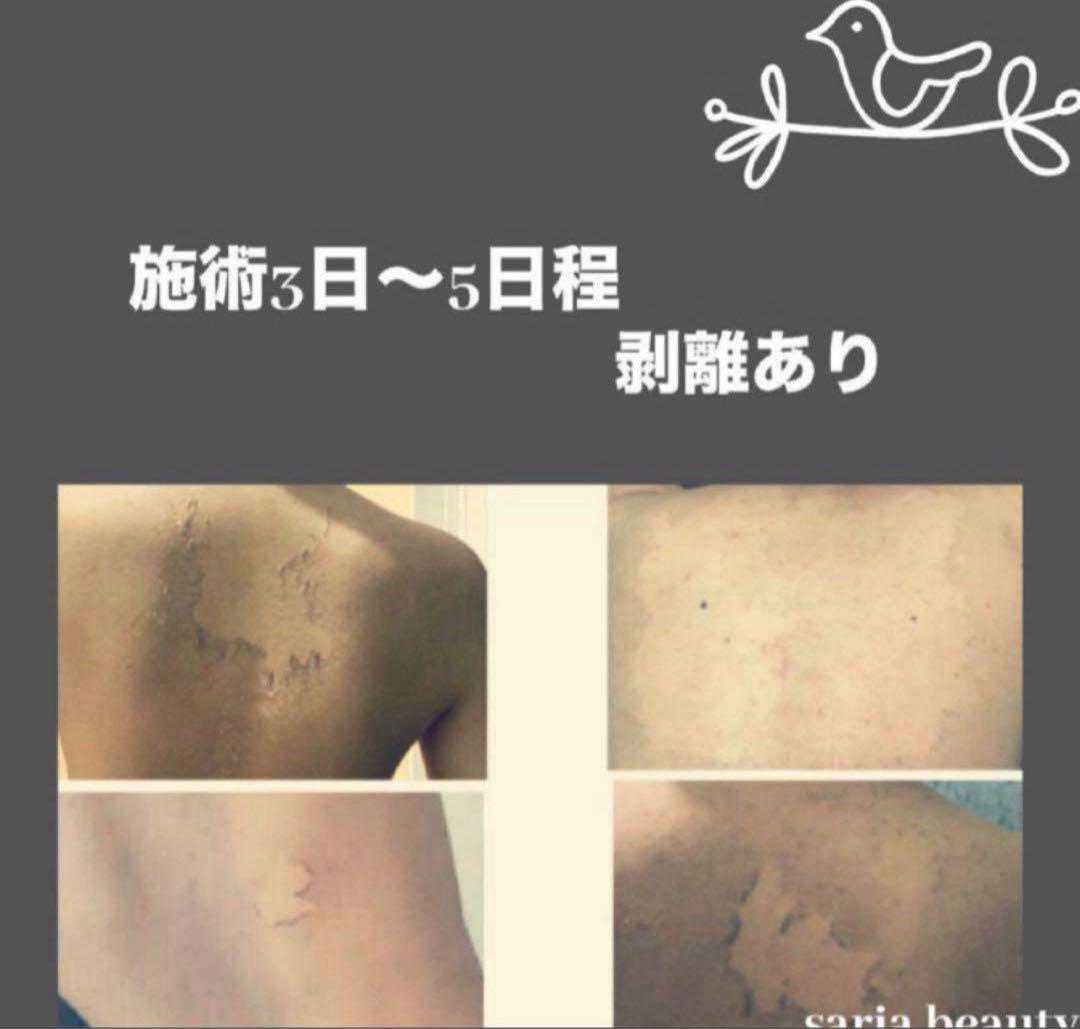 ハーブピーリング　業務用　剥離あり　CICA アロエベラ　オーガニック　和漢