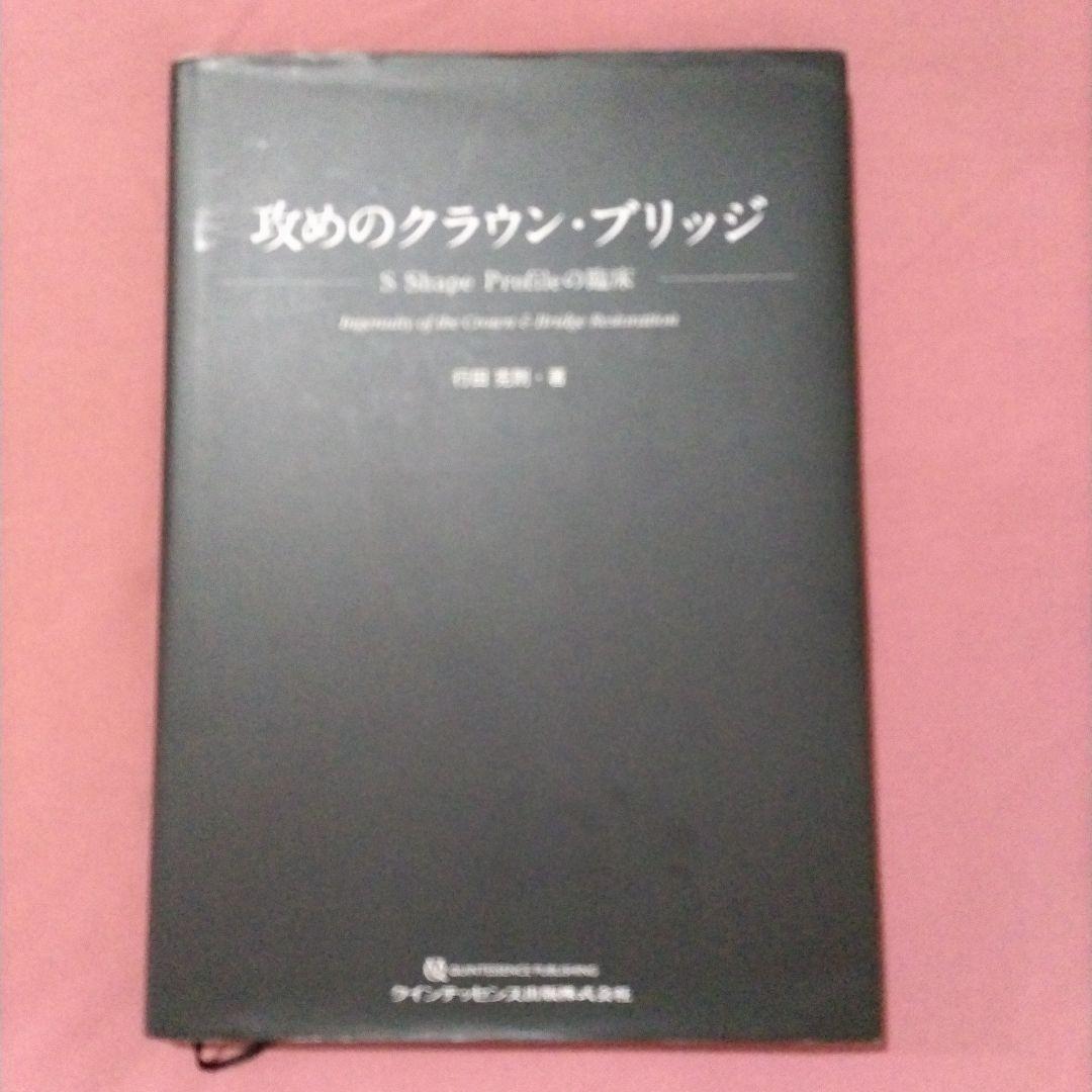 攻めのクラウン・ブリッジ = Ingenuity of the Crown &…