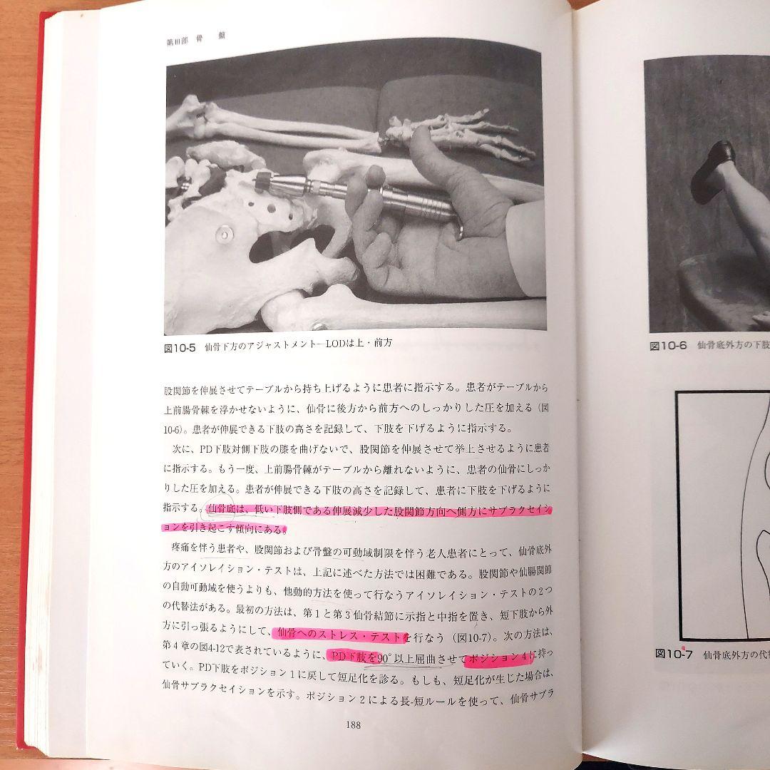 アクティベーターメソッド　カイロプラクティック・テクニック