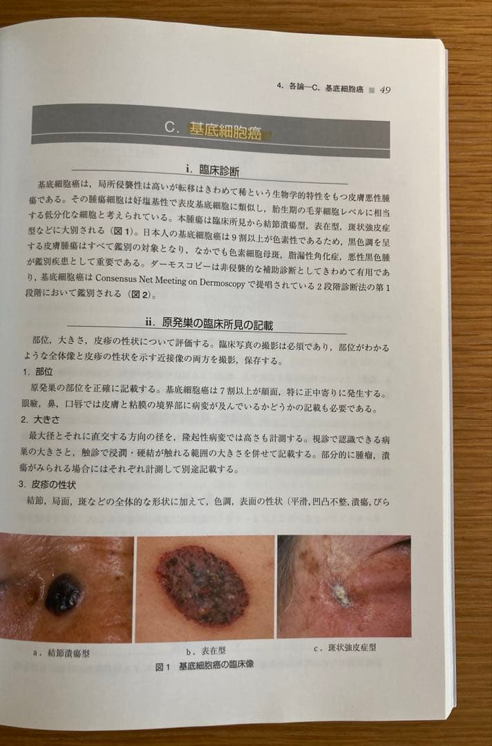 皮膚悪性腫瘍取扱い規約 2010年8月　形成外科　皮膚科　皮膚癌　医学書