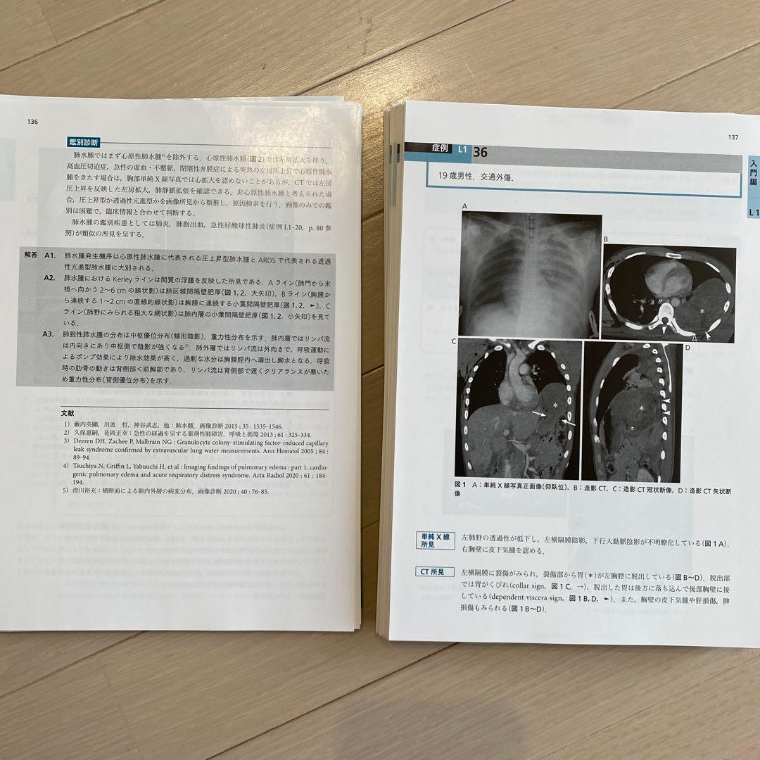 【裁断済み】即戦力が身につく　胸部の画像診断