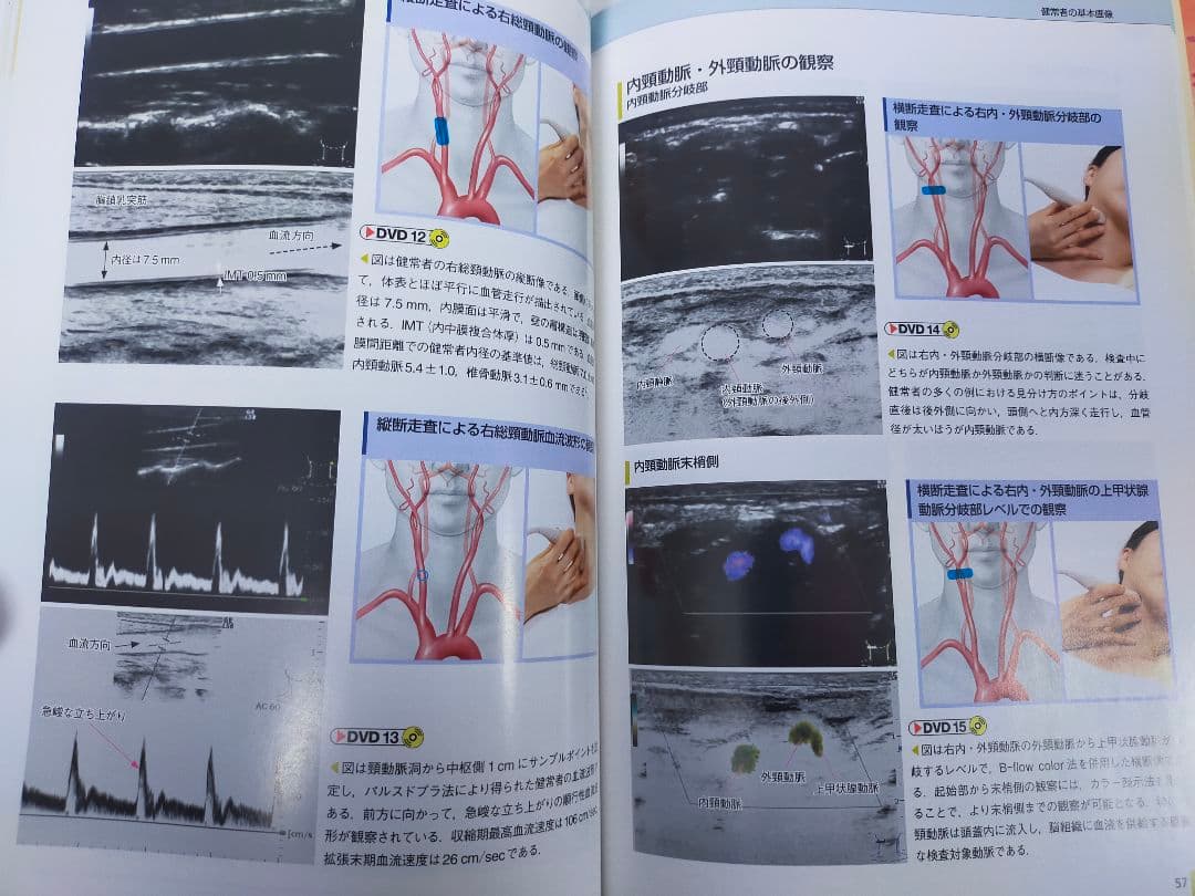 頸動脈エコーテキスト／２冊セット