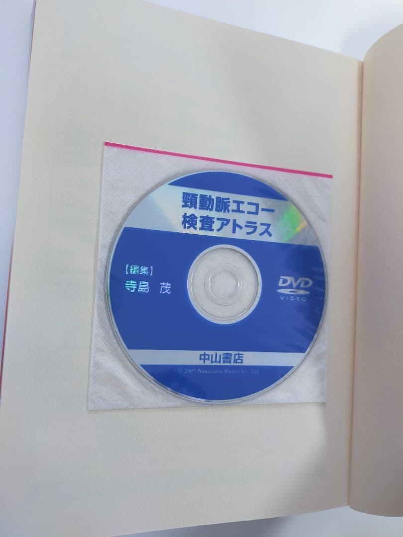 頸動脈エコーテキスト／２冊セット