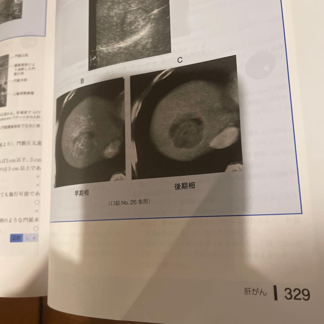 腫瘍学問題集 第10版
