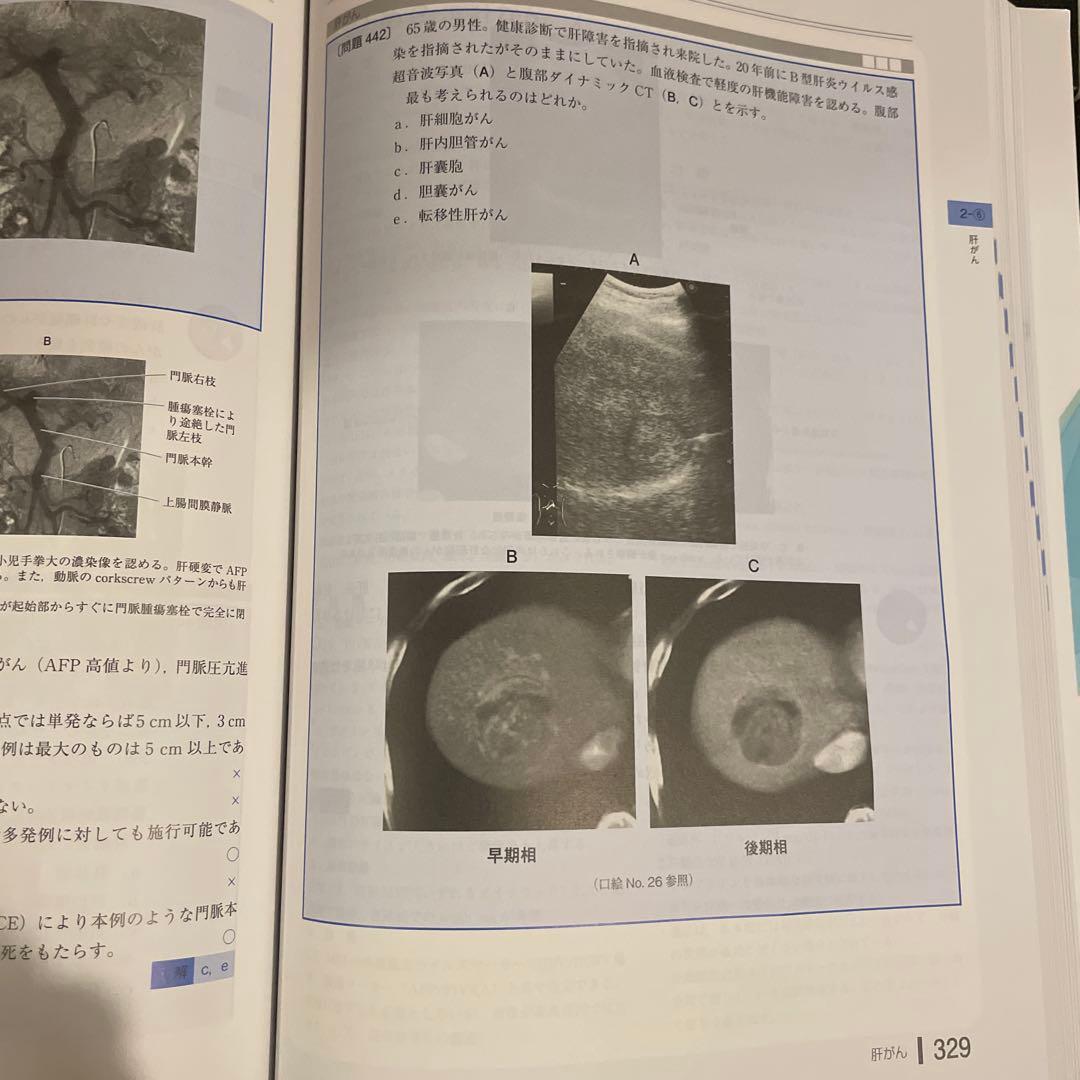 腫瘍学問題集 第10版