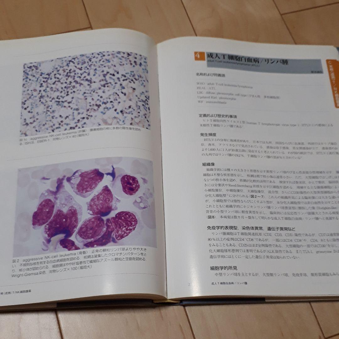 最新・悪性リンパ腫アトラス