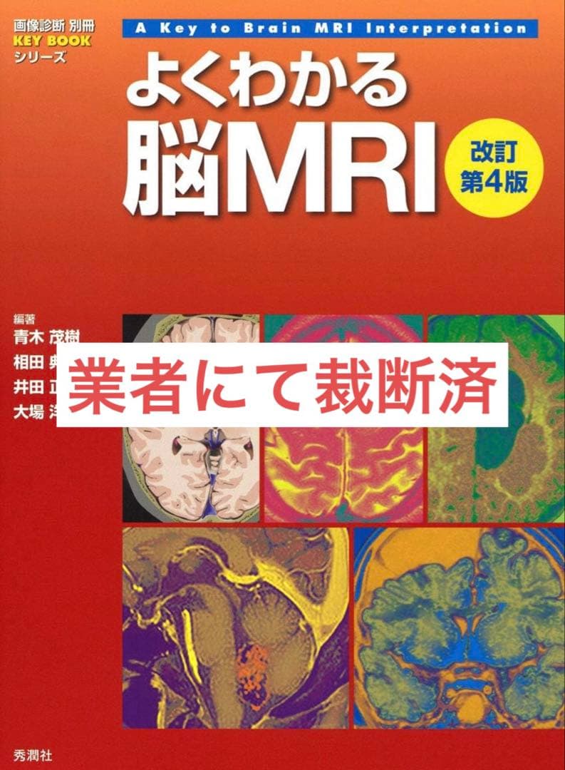 『裁断済』よくわかる脳MRI