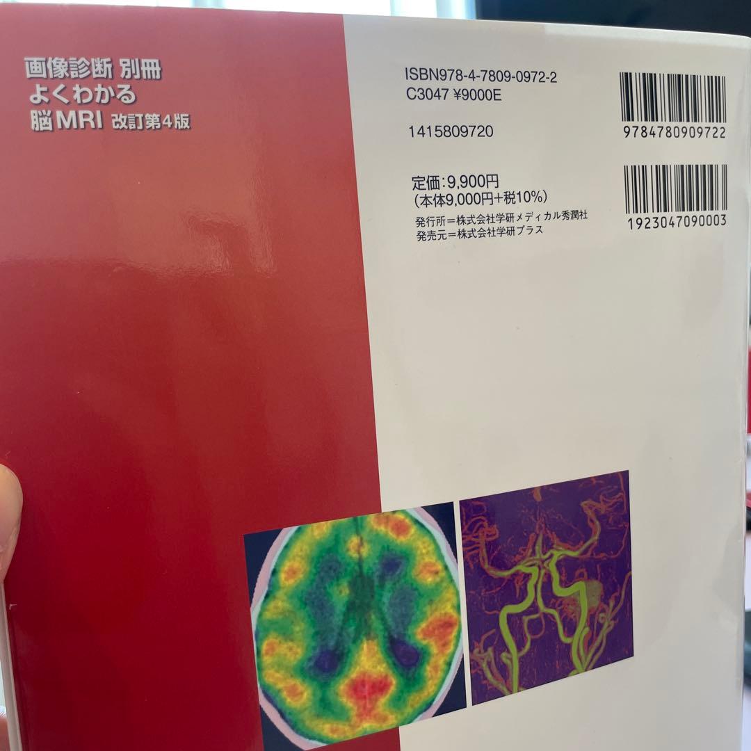 よくわかる脳MRI